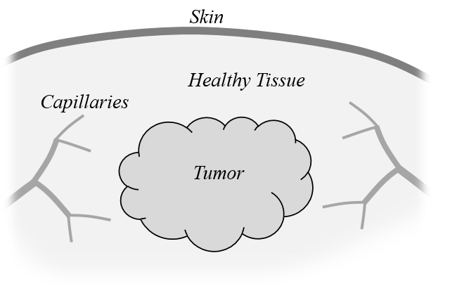 健康组织的肿瘤图片。