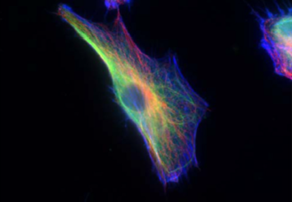 成纤维细胞的细胞骨架以蓝色，绿色和红色可视化。