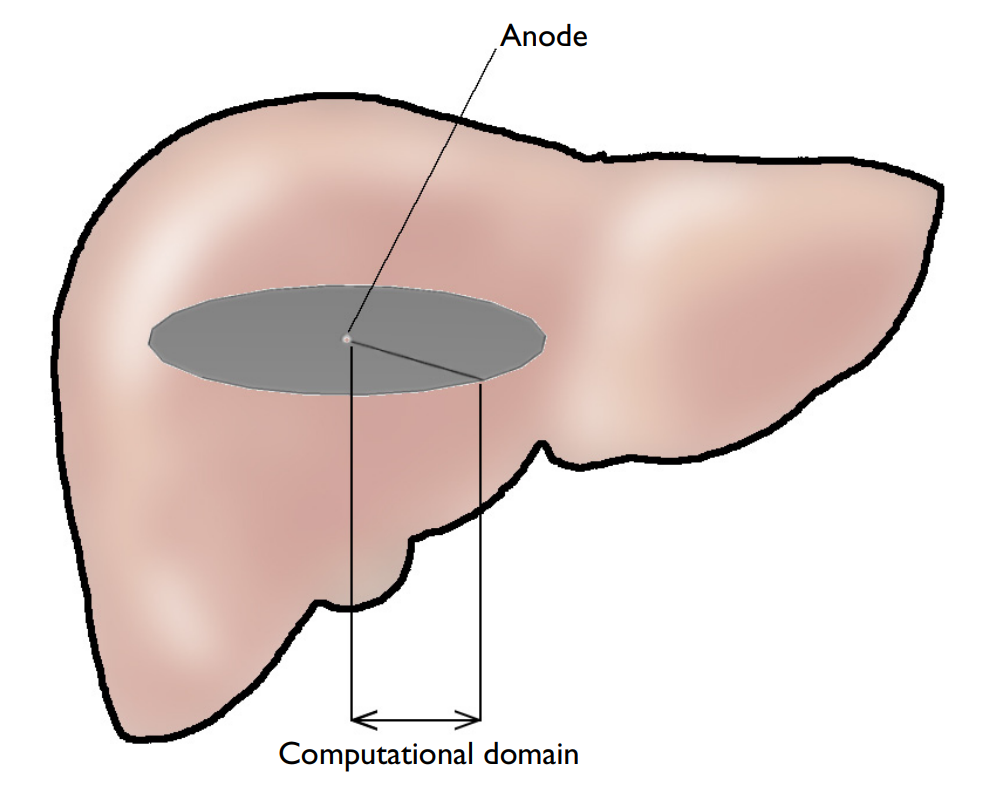 ECHT模型的肝，肿瘤和阳极的示意图。