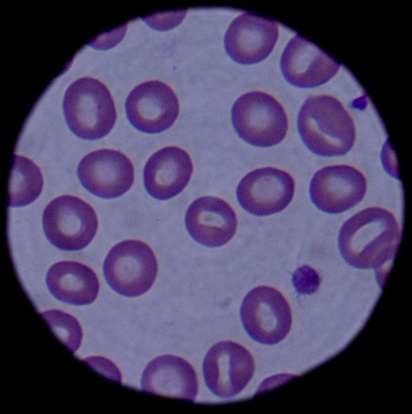 在现代显微镜方面的血细胞图像。