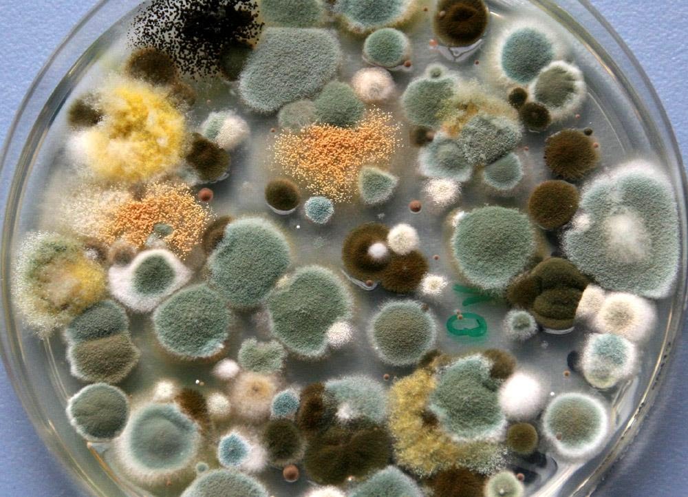 培养皿中霉菌的特写照片。
